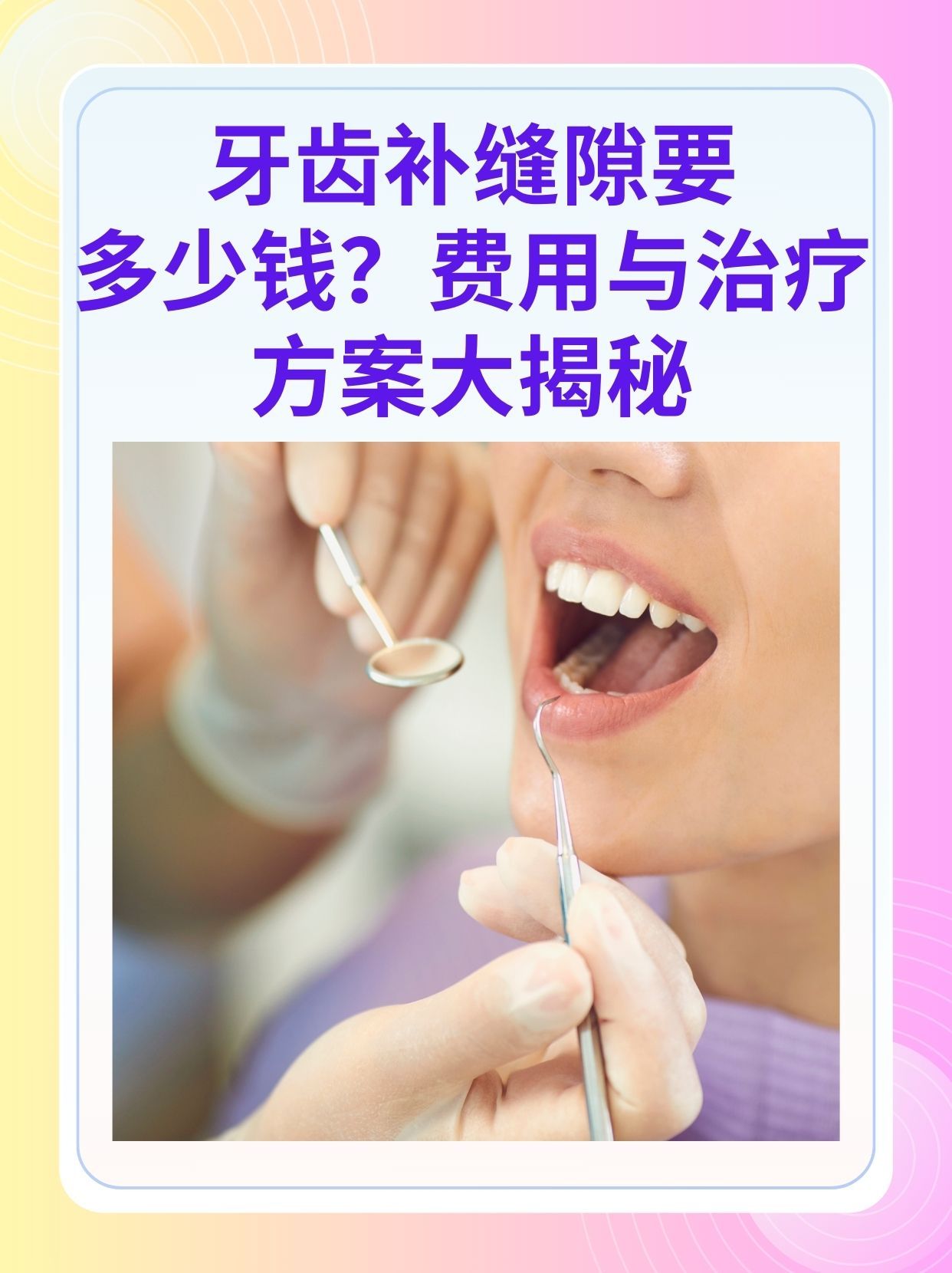 保定补牙医保可以报销吗(补牙医保可以报销吗 哪些可以报销呢)